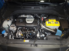 画像をギャラリービューアに読み込む, Injen 18-20 Hyundai Kona L4-1.6L Turbo Laser Black IS Short Ram Cold Air Intake System